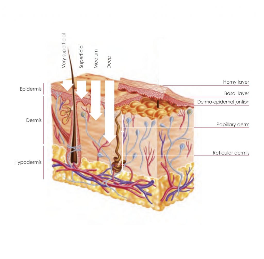 NANOPEELS – leaderma