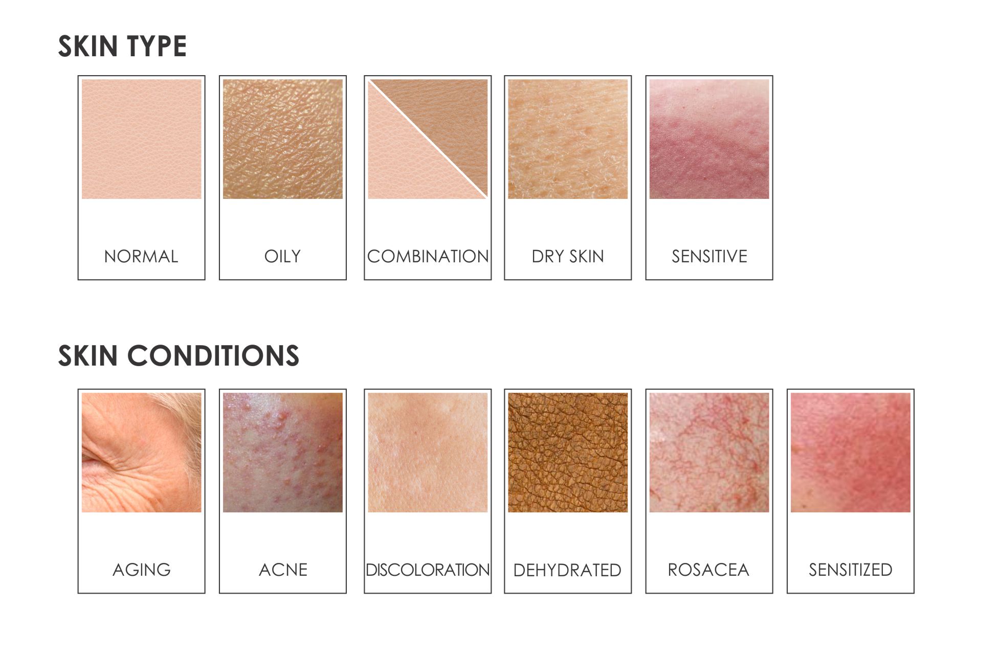 SKIN TYPES & CONDITIONS – leaderma